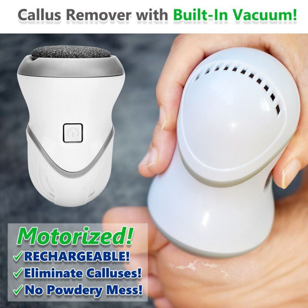 Rechargeable Foot Scrub Grinder To Dead Skin Grinding Artifact Exfoliate Kill Calluses Microdermabrasion Peeling Device