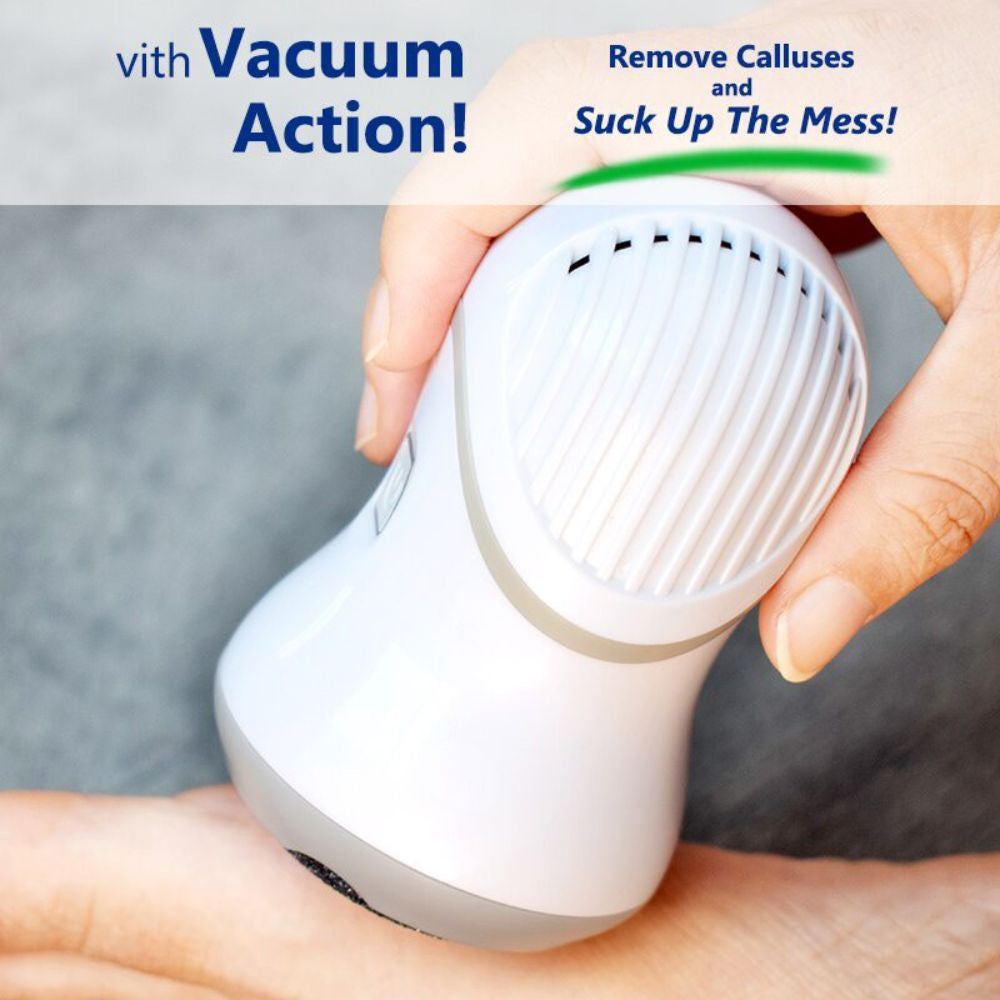 Rechargeable Foot Scrub Grinder To Dead Skin Grinding Artifact Exfoliate Kill Calluses Microdermabrasion Peeling Device
