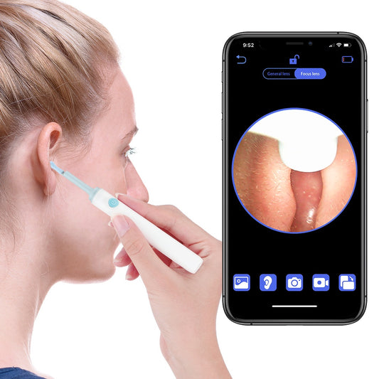 Earview 3.9mm Earpick With Camera Adult Otoscope Endoscope Camera for Android IOS Earwax Removal Kit Ear Cleaner